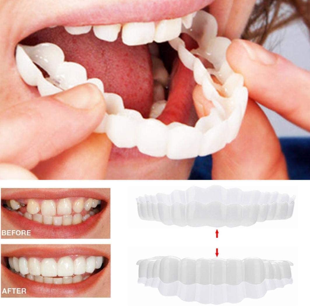 Dental Veneer Set Includes Upper And Lower Teeth For Natural Smile