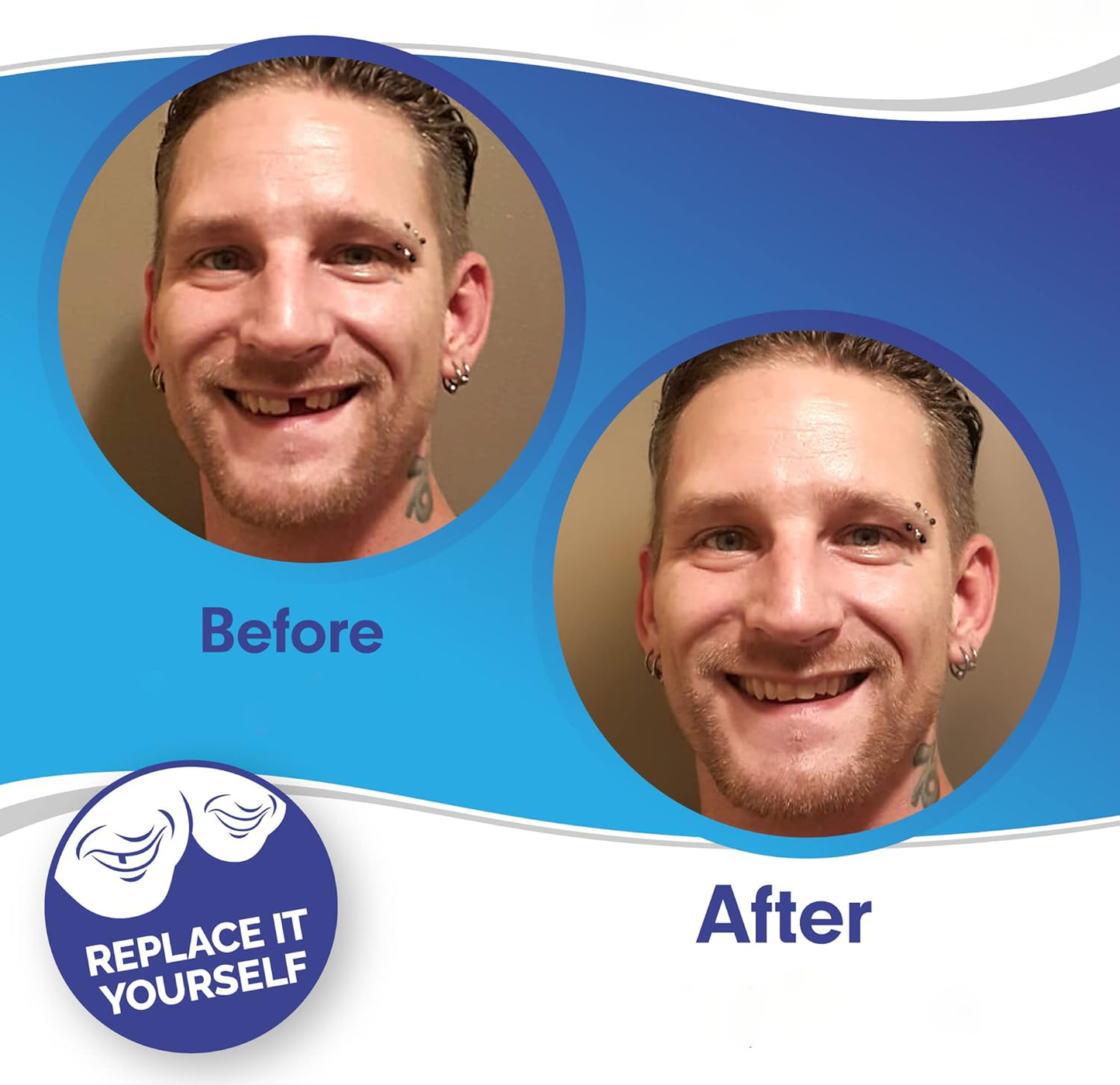Dental Veneer Set Includes Upper And Lower Teeth For Natural Smile