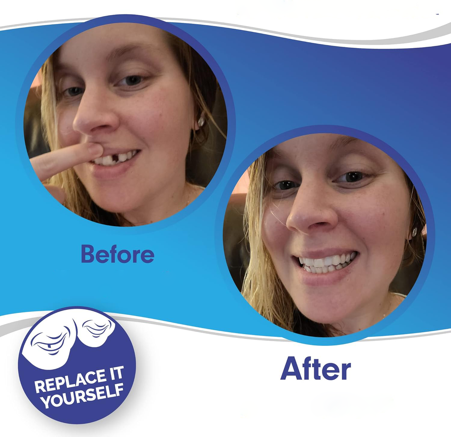 Dental Veneer Set Includes Upper And Lower Teeth For Natural Smile