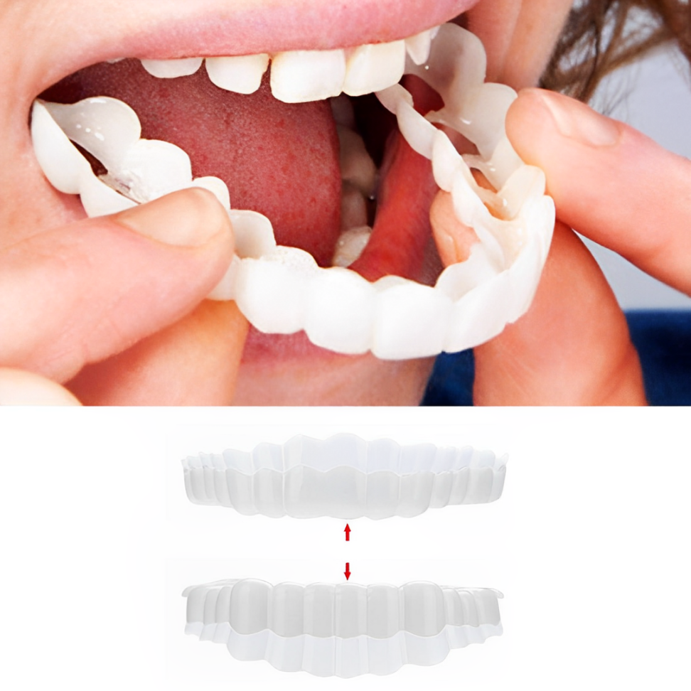 Dental Veneer Set Includes Upper And Lower Teeth For Natural Smile