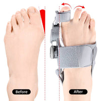 Toe Spacer Bunion Alignment Gel Pads Adjustable Night And Day Comfort