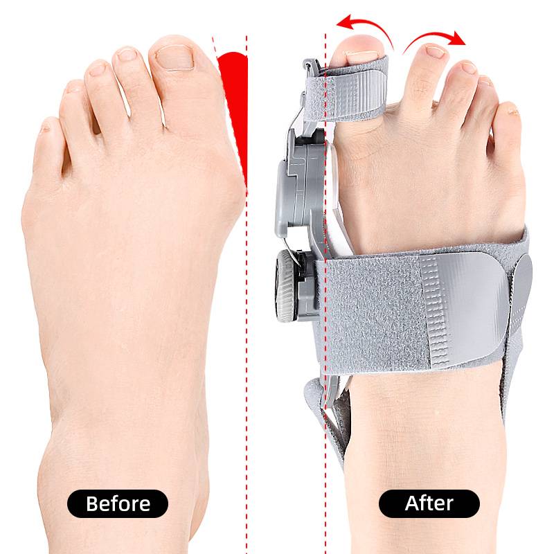 Toe Spacer Bunion Alignment Gel Pads Adjustable Night And Day Comfort