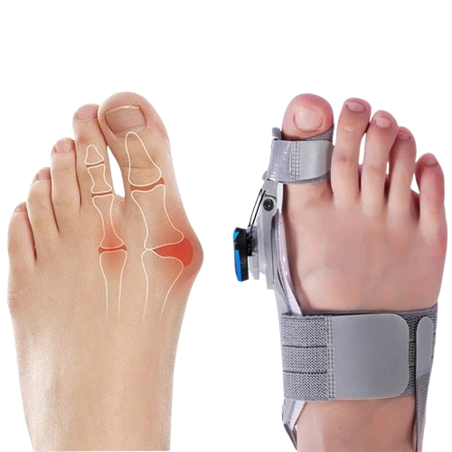 Toe Spacer Bunion Alignment Gel Pads Adjustable Night And Day Comfort
