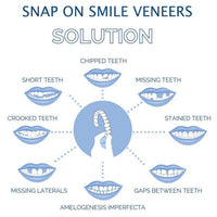 Dental Veneer Set Includes Upper And Lower Teeth For Natural Smile